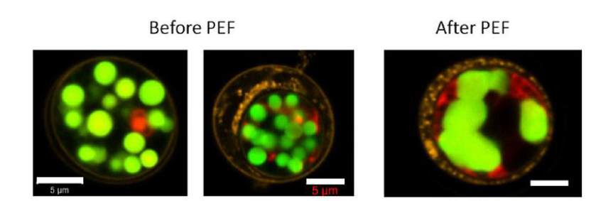 microscopie confocale